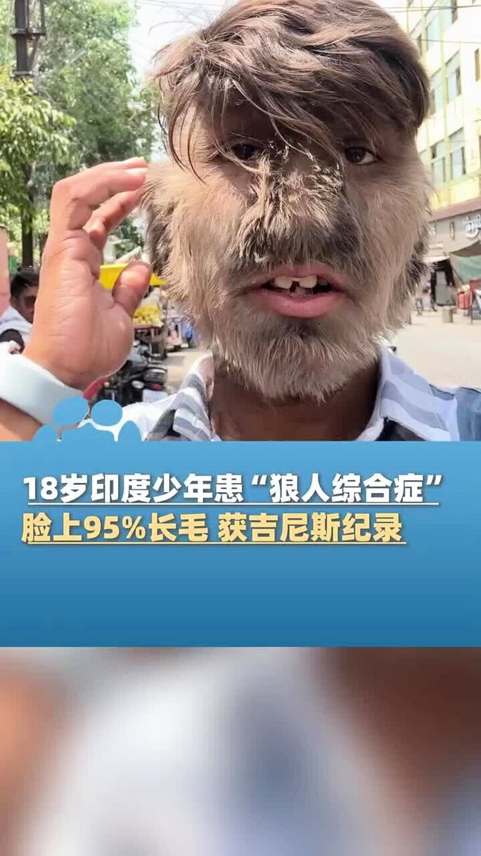 懂色AV国产精品| 高清无码在线观看 | 国产自拍精品视频大全